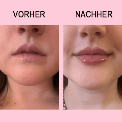 HELLIORA™ - LipLift Boost